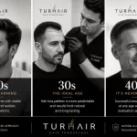 Best age for hair transplant comparison showing patients in their 20s, 30s and 40s with doctor-led planning at TurHair.