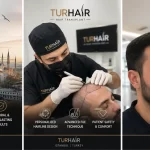 Hair transplant in Istanbul at TurHair by Dr. Mehmet Sirac Demir with natural hairline design, doctor-led FUE treatment and successful patient results.