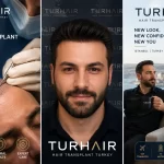 FUE Hair Transplant Turkey 2026 – TurHair Istanbul hair transplant clinic