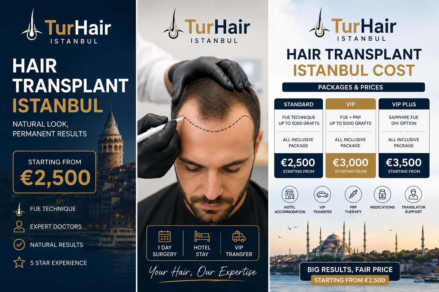 Hair Transplant Istanbul Cost – TurHair hair transplant packages in Istanbul starting from €2,500