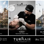 Hair transplant comparison between the Netherlands and Turkey showing costs, doctor-led treatment, all-inclusive packages and TurHair clinic in Istanbul.
