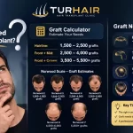 How many grafts do I need for a hair transplant – TurHair graft calculator showing hairline, crown and Norwood scale graft estimates