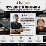 Лучшие клиники по пересадке волос в Турции — TurHair и Dr. Mehmet Sıraç Demir