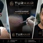 Top 10 Hair Transplant Clinics in Turkey – TurHair doctor-led hair transplant with Dr. Mehmet Sıraç Demir